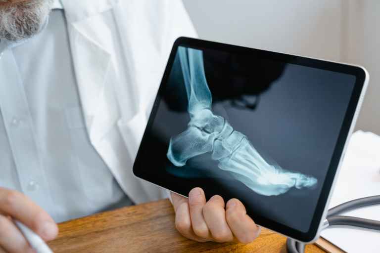 person holding an x ray result of a foot - best radiology website
