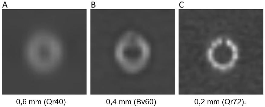 improved stent imaging photon-counting CT PCD-CT detectors higher resolution
