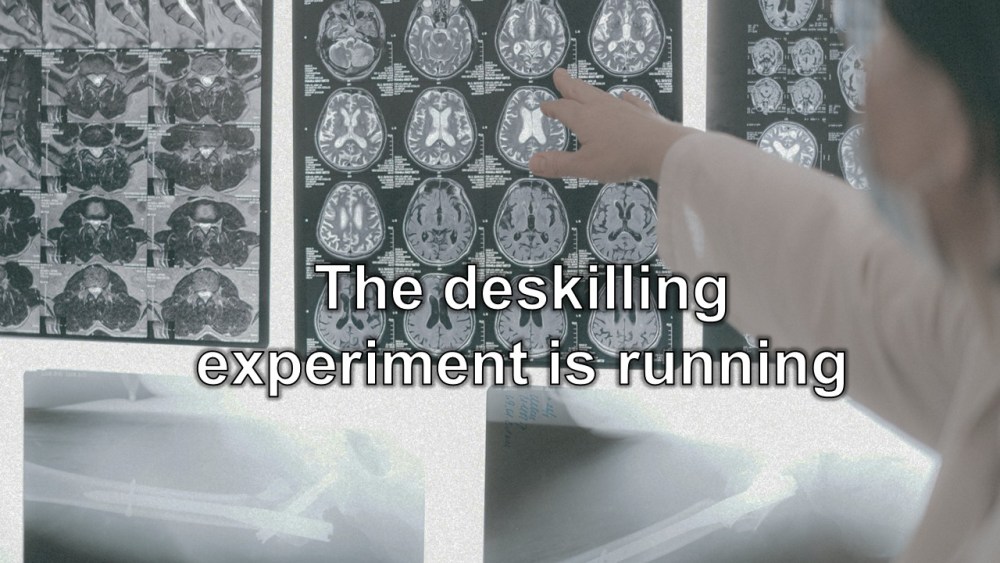 When AI Reads the Easy Cases: Radiology’s Training Paradox